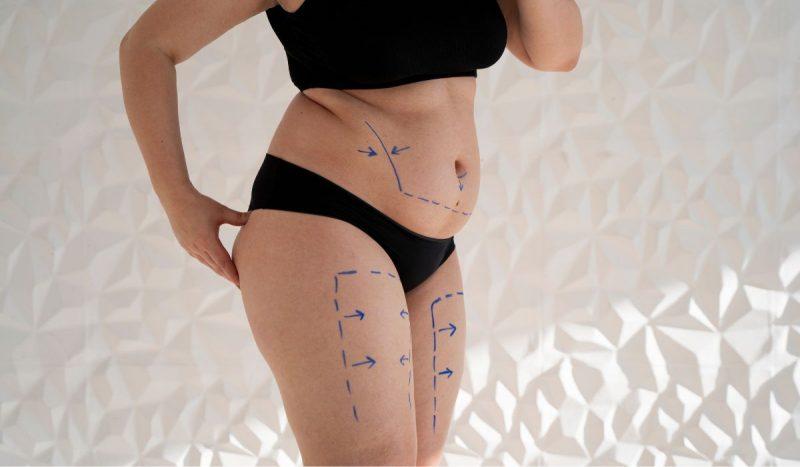 ‘Risco de morte’: Conselho de Medicina pede à Anvisa proibição do PMMA no Brasil