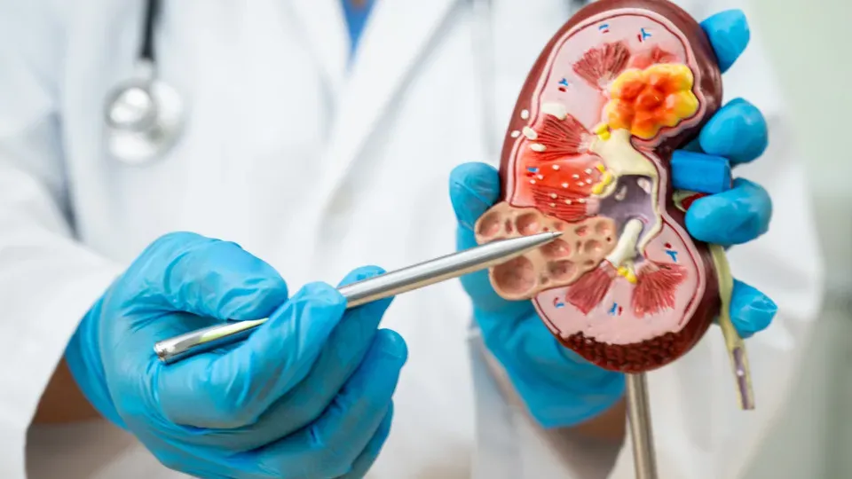 8 hábitos que podem estar destruindo seus rins sem você perceber